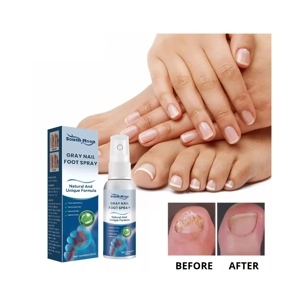 Fingernail and Toenail Fungus Treatment in Just 7 Days